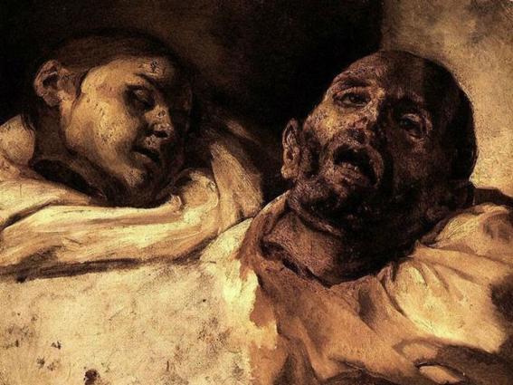 Théodore Géricault, The Severed Heads. On the left side is the female head which has closed eyes and bright white skin, while on the right is the male head with open mouth and open eyes which look at the viewer freely. Serrated, rough spots on the neck illustrate the cruel and torturous death these characters have agonized at the guillotine. Loose lines for the visualization of face and tissue contribute to the dramatic effect of the work.