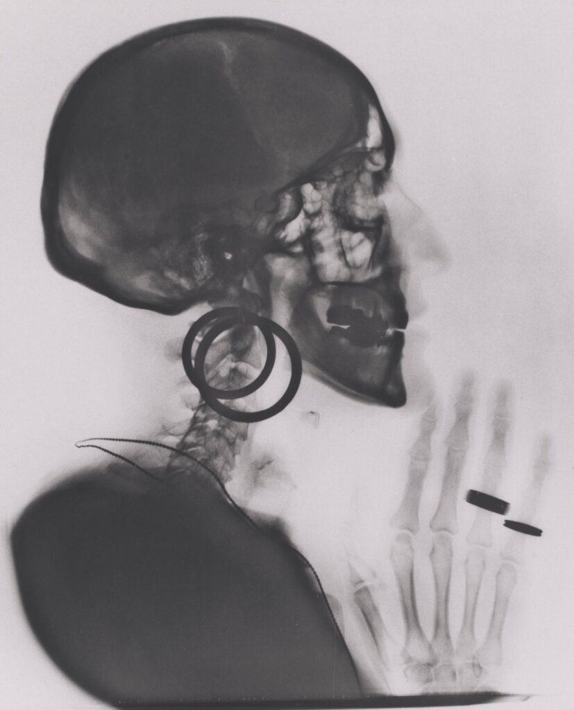 Meret Oppenheim: Meret Oppenheim, X-ray of My Skull, 1964, San Francisco Museum of Modern Art, San Francisco, CA, USA.
