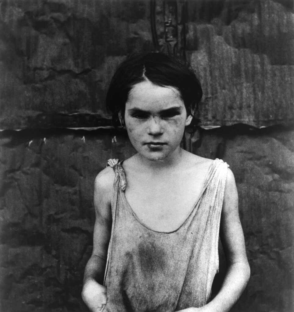 Dorothea Lange Family of Man: Dorothea Lange, Damaged Child, Shacktown, Elm Grove, Oklahoma, 1936, Museum of Modern Art, New York City, NY, USA. Museum’s website.
